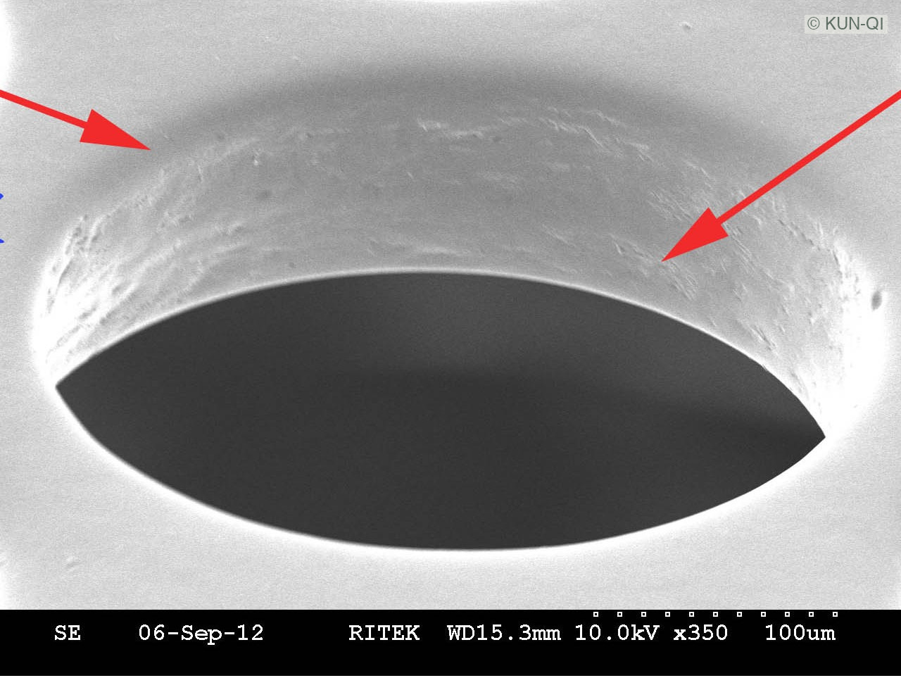 A｜SMT — 100 μm