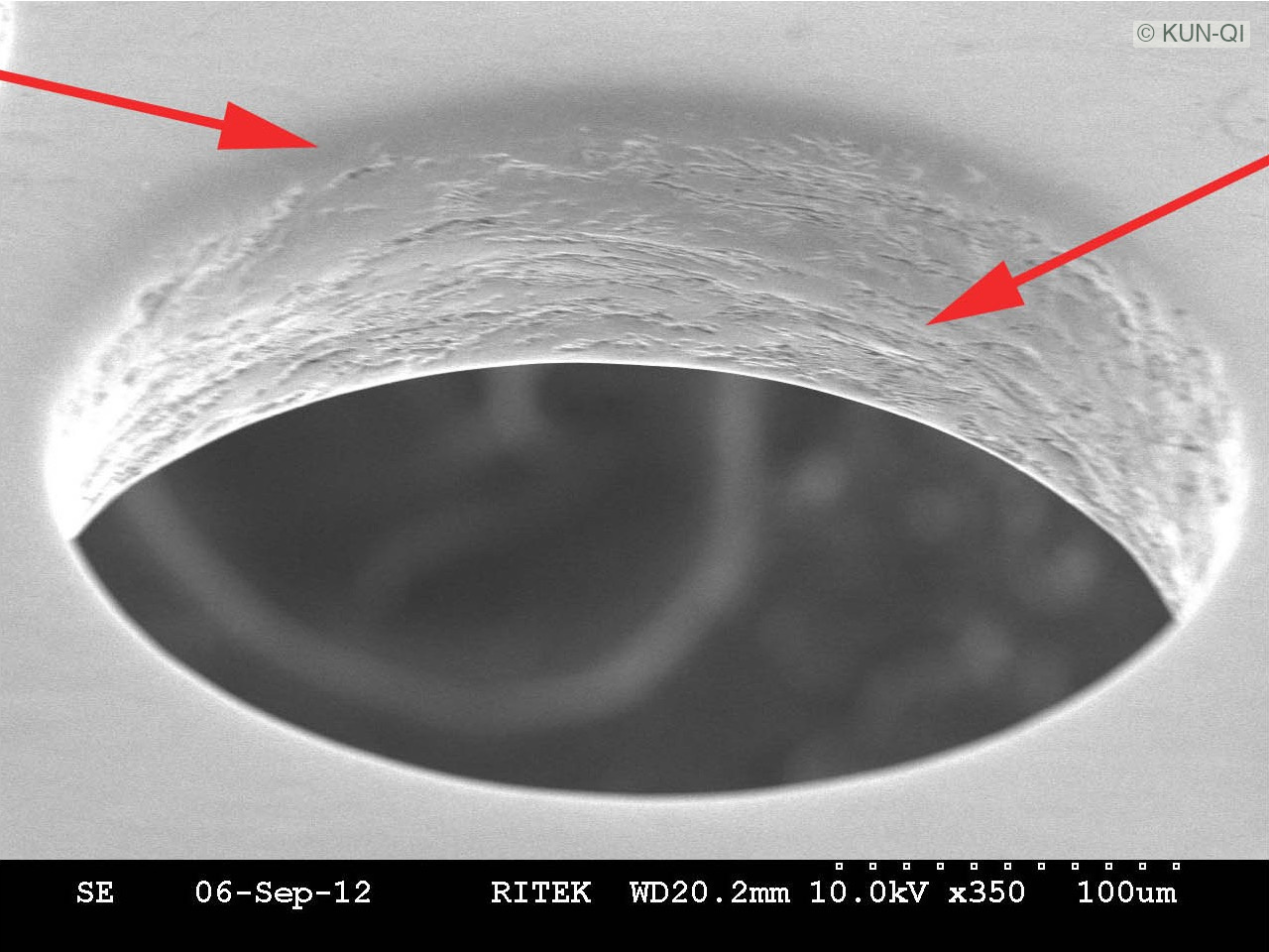 B｜SMT — 100 μm